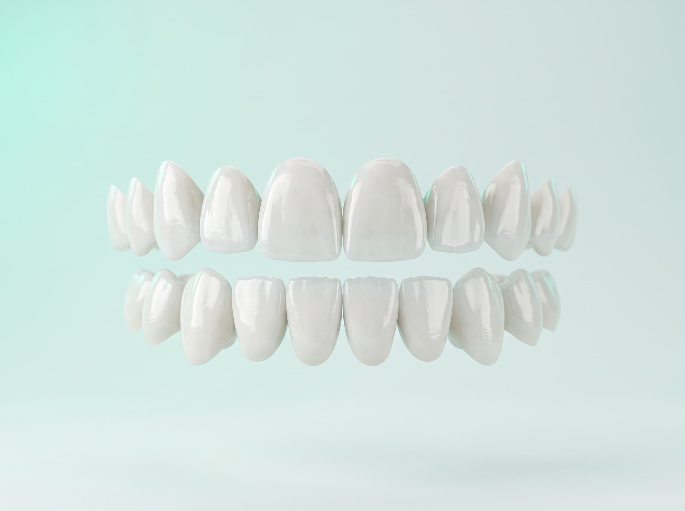 Hollywood Smile